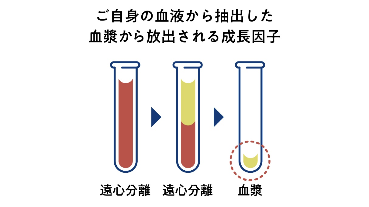 『血漿由来因子』療法