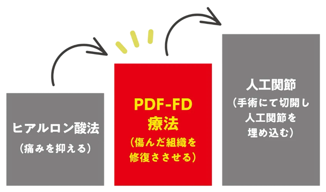 PDF-FD®療法について