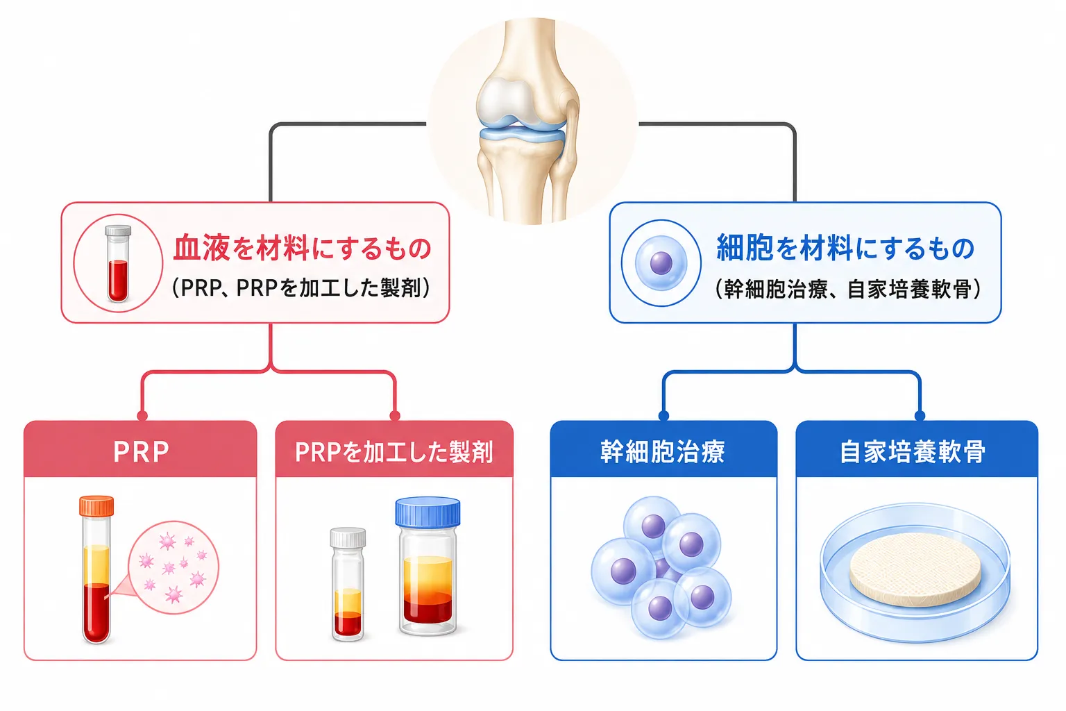 膝の再生医療を材料で分類した図。血液を材料にするものと細胞を材料にするものの2系統