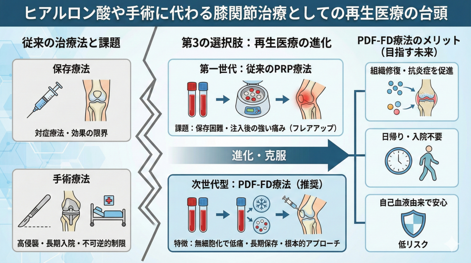 ヒアルロン酸や手術に代わる膝関節治療としての再生医療の台頭を示す図解。従来の保存療法（対症療法・効果の限界）と手術療法（高侵襲・長期入院・不可逆的制限）の課題、第3の選択肢である再生医療の進化（第一世代の従来PRP療法から次世代型PDF-FD療法へ）、そしてPDF-FD療法のメリット（組織修復・抗炎症を促進／日帰り・入院不要／自己血液由来で低リスク）を整理した図。